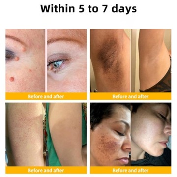 Корректирующий крем с пчелиным ядом, увлажняющий увлажняющий крем, удаление пятен