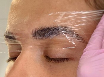 Осмотическая фольга для окклюзии ножом Prima Derma.