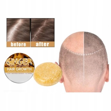 3 шт имбирный шампунь для роста волос.