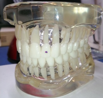 Зубные украшения Quarkee Crystal Clear 1,8 мм AB