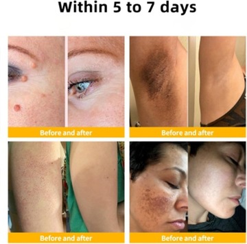 Diapason LIPOGO Крем для лечения пчелиного яда, гель для лечения пчелиного яда для всех