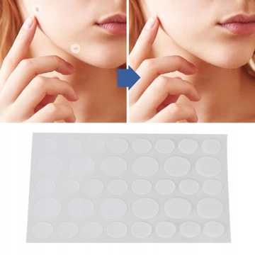 УДАЛЕНИЕ БОРОДКИ УДАЛЕНИЕ КОЖНОЙ ТЕГКИ РОДИНКА