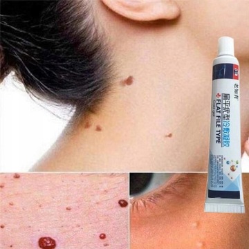 Мазь для удаления кондилом вульвы и бородавок