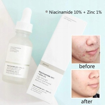 The Ordinary Ниацинамид 10% + Цинк 1% 30 мл