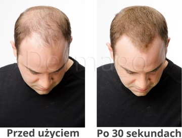 Спрей-загуститель из микрофибры 200 мл за 100 зл.