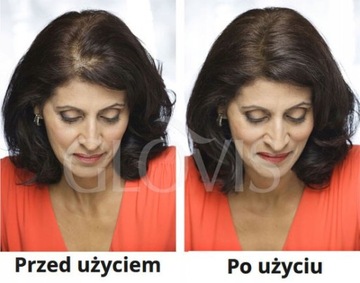 GLOVIS Hair MakeUp Topical Shader Маскирующая пудра