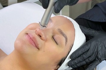 Устройство для водной дермабразии и инфузии кислорода Zemits DermeLuxx