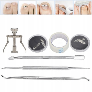 НАБОР КОРРЕКЦИОННЫХ КРОНШТЕЙНОВ ДЛЯ ВРАСТНЫХ НОГТЕЙ