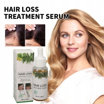 60 МЛ МАСЛО РОЗМАРИНА ДЛЯ ЛЕЧЕНИЯ РОСТА ВОЛОС