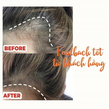 масло для роста волос питает волосяные луковицы