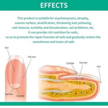 OUHOE Nail Repair Essence Nail