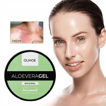 АЛОЭ УСПОКАИВАЮЩИЙ ГЕЛЬ - АЛОЭ ГЕЛЬ 50г