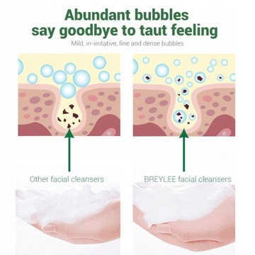 Очищающее средство для лица от прыщей на лице Linhuihui