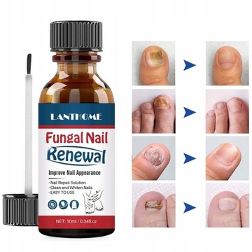 Płyn Do Naprawy Paznokci Lanthome 10ml