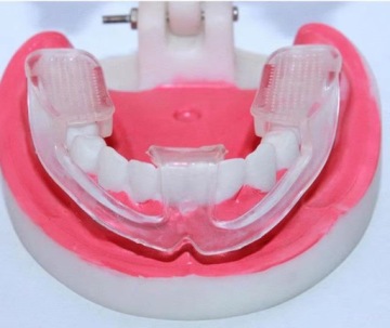 Накладка от бруксизма 4x Teeth Relaxation Rail Tooth Grinding Overlay