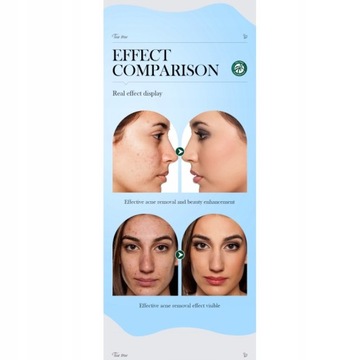 Осветляющий крем для кожи подмышек для удаления меланина