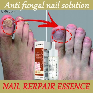 Грибок ногтей Strong Nail Repair Liquid