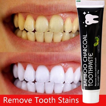 ЗУБНАЯ ПАСТА БЕЛИВАЮЩАЯ С АКТИВИРОВАННЫМ УГЛЕМ 105г