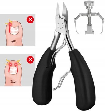 ZESTAW NA WRASTAJĄCE PAZNOKCIE KOREKCYJNY KLAMRA PODOLOGIA DOMOWA