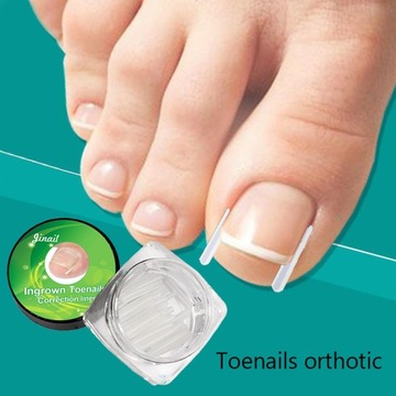 10 шт силиконовых полосок для вросших ногтей на ногах.