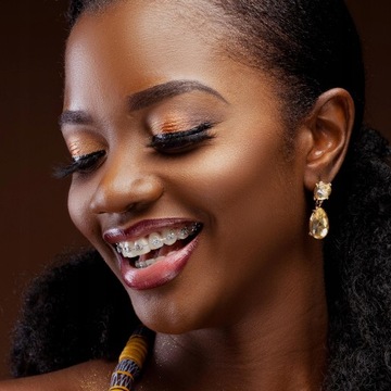 Продукт Hollow Base Lingual 200 металлических пуговиц