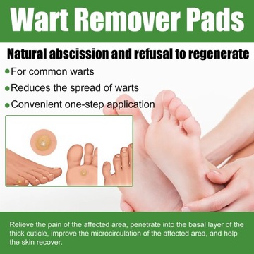 Мозольные подушечки для ног удаляют плоские нитевидные мозоли