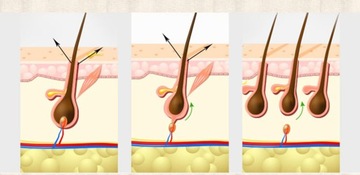 Спрей для роста бороды, загущение, регенерация Севич + валик + масло для бороды