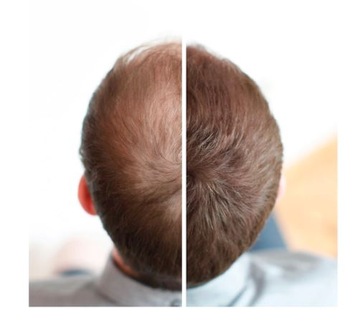 RELIGHT волокна для утолщения волос КОРИЧНЕВЫЙ 12г