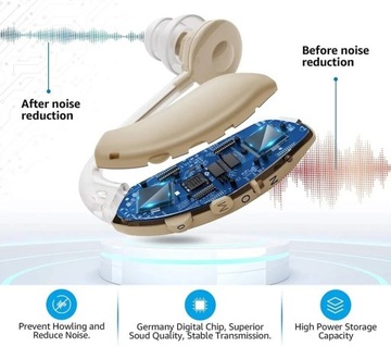 Aparat Słuchowy PROFESJONALNY! USŁYSZYSZ WIĘCEJ!