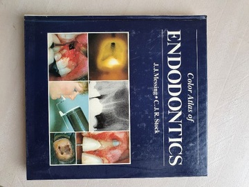 Colour atlas of endodontics J.J.Messing