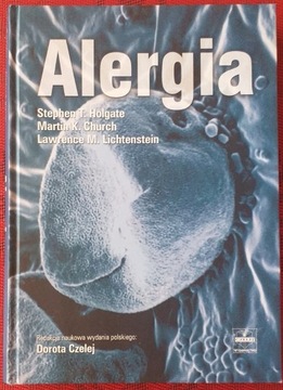 Alergia Stephen T. Holgate Martin K. Church
