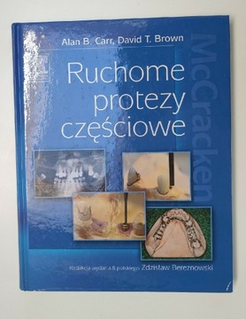 Ruchome protezy częściowe McCracken, Alan B. 