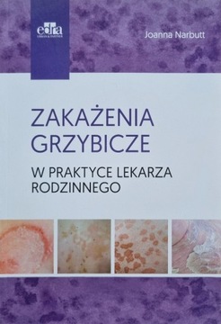 Zakażenia grzybicze w praktyce lekarza rodzinnego