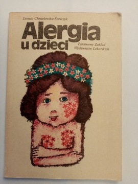 Alergie u dzieci