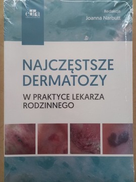 Najczęstsze Dermatozy W Praktyce Lekarza Rodz.