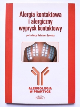 Alergia kontaktowa i alergiczny wyprysk