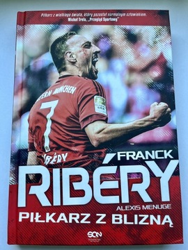 Franck Ribery - Piłkarz z blizną