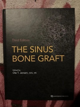 The Sinus Bone Graft Third Edition - Ole T.Jensen