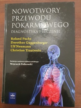 Nowotwory przewodu pokarmowego.Diagnostyka i lecze