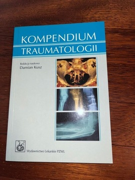 Kompendium traumatologii 