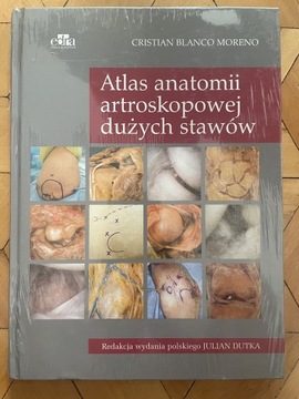 Atlas anatomii artroskopowej dużych stawów