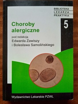 Choroby alergiczne - Zawisza, Smoliński
