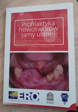 Profilaktyka nowotworów jamy ustnej 