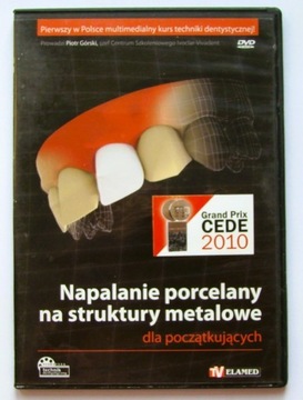 Napalanie porcelany na struktury metalowe