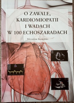 O zawale, kardiomiopatii i wadach w 100 echoszarad