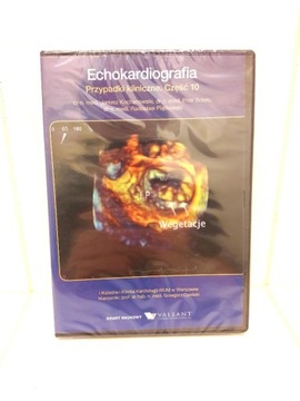 DVD Echokardiografia przypadki kliniczne część 10