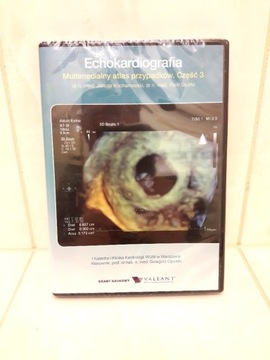 DVD Echokardiografia przypadki kliniczne atlas 3