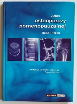 Atlas osteoporozy pomenopauzalnej - Rene Rizzoli