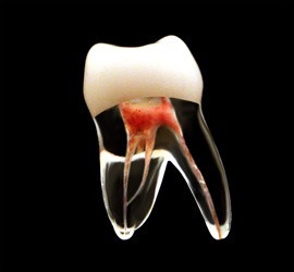 zęby endodontyczne DRSK 