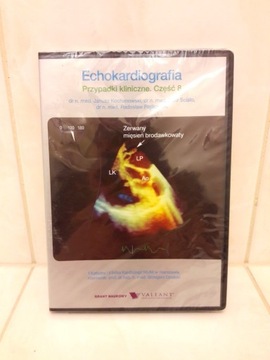 Echokardiografia przypadki kliniczne 8 DVD Opolski